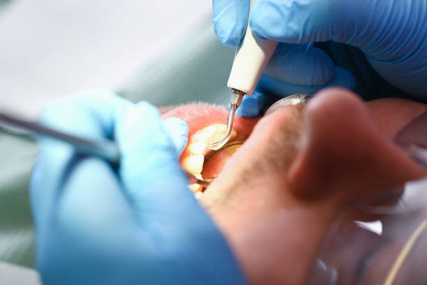 Best Pediatric Emergency Dentist in Continental, OH