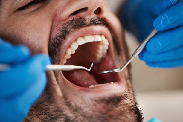 Best Walk-In Emergency Dentist in Continental, OH